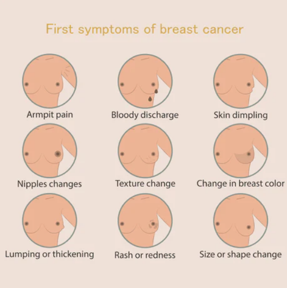 أعراض سرطان الثدي المبكرة